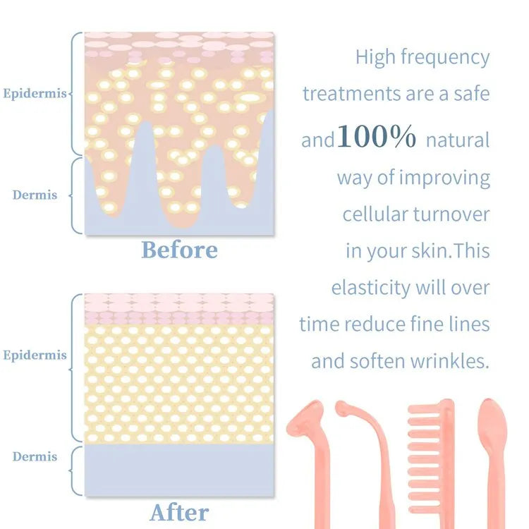 Portable High Frequency Skin Therapy Wand